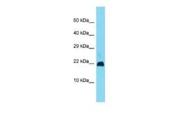 Gm11686 Rabbit anti-Mouse, Polyclonal, Novus Biologicals 100 &mu;g | Buy Online | Novus Biologicals | Fisher Scientific